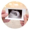ultrasound-scan-images-of-a-developing-baby